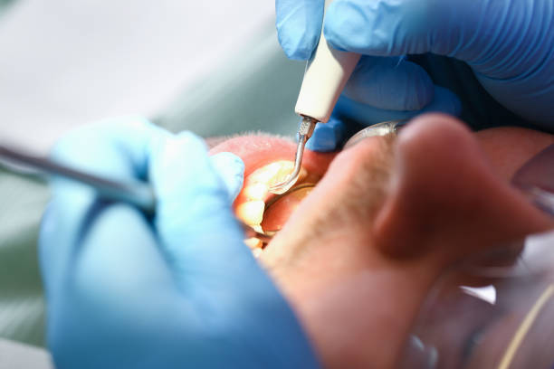 Best Emergency Denture Repair in Prophetstown, IL