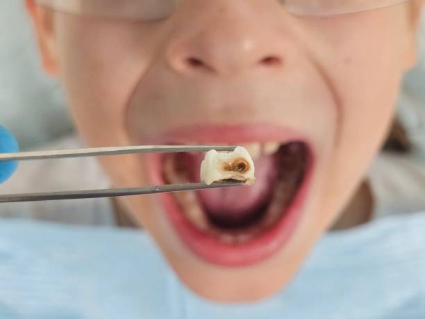 Best Emergency Treatment for Jaw Pain or Injury in Prophetstown, IL