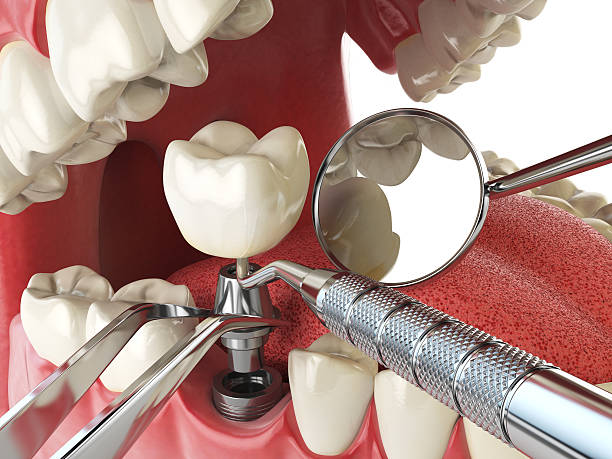 Best Walk-In Emergency Dental Services in Prophetstown, IL